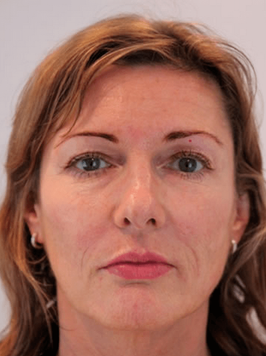 Tunnen end pärast Eudalie kursust noorem
